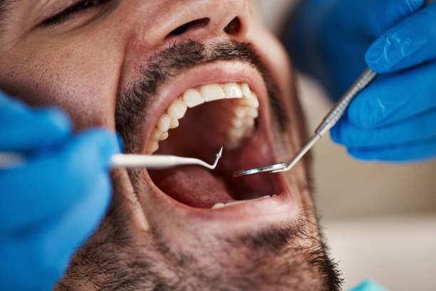 Best Mobile Emergency Dentist in Boulder Hl, IL